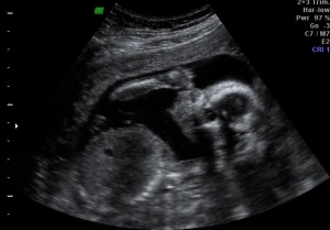 baby-ultrasound-yet-I-trust